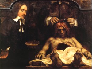 Anatomy of Doctor Deyman by Rembrandt Van Rijn Oil Painting Reproduction